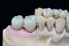 DSKR0609